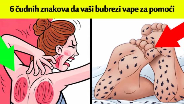 bubrezi-sshot-48-640x360